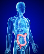 Cancro del colon-retto, l’infiammazione prodotta dalla dieta fa aumentare il rischio di svilupparlo